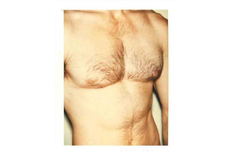 Photo of a man's bare torso